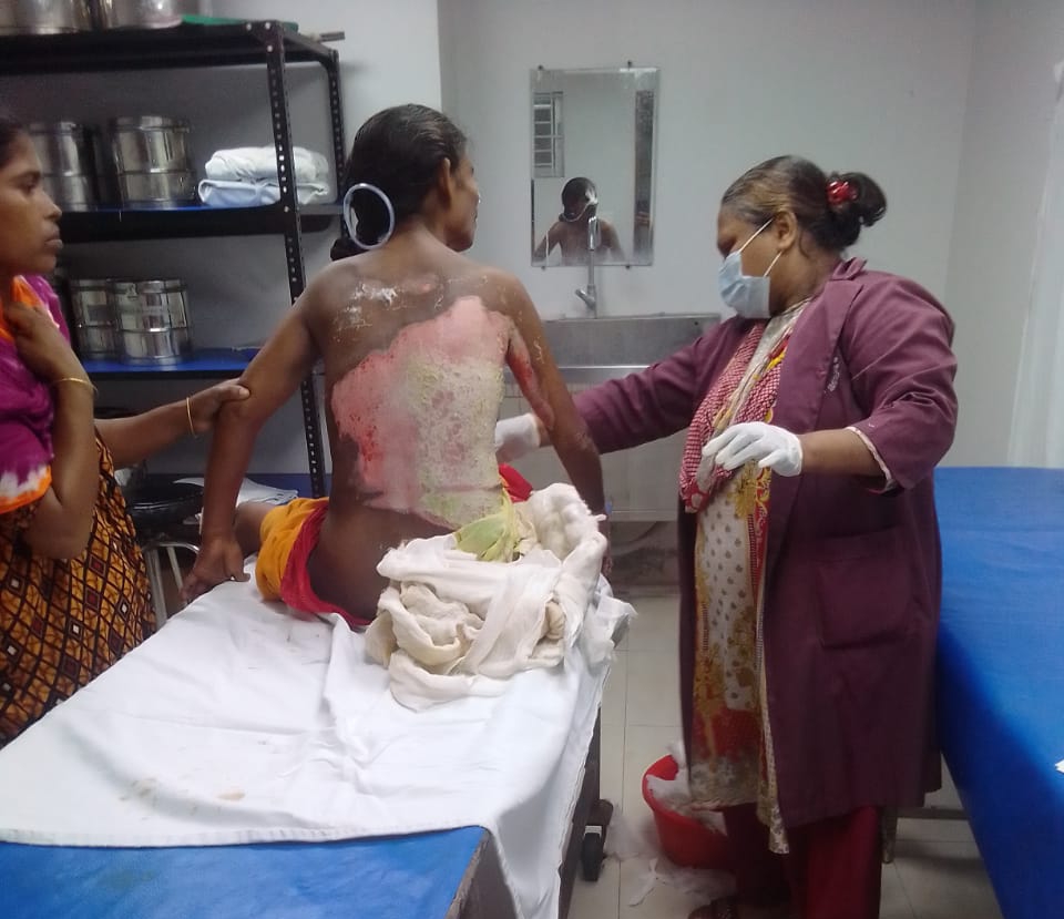 দিগপাইত ইউনিয়নের হবদেশ গ্রামে এই জীবন্ত মানুষকে পুড়িয়ে মারার চা*ঞ্চল্যকর ঘটনায় মৃত্যু 