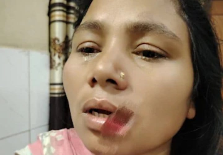 রাজবাড়ীতে ননদের কামড়ে ছিড়ে গেছে ভাবীর ঠোঁট