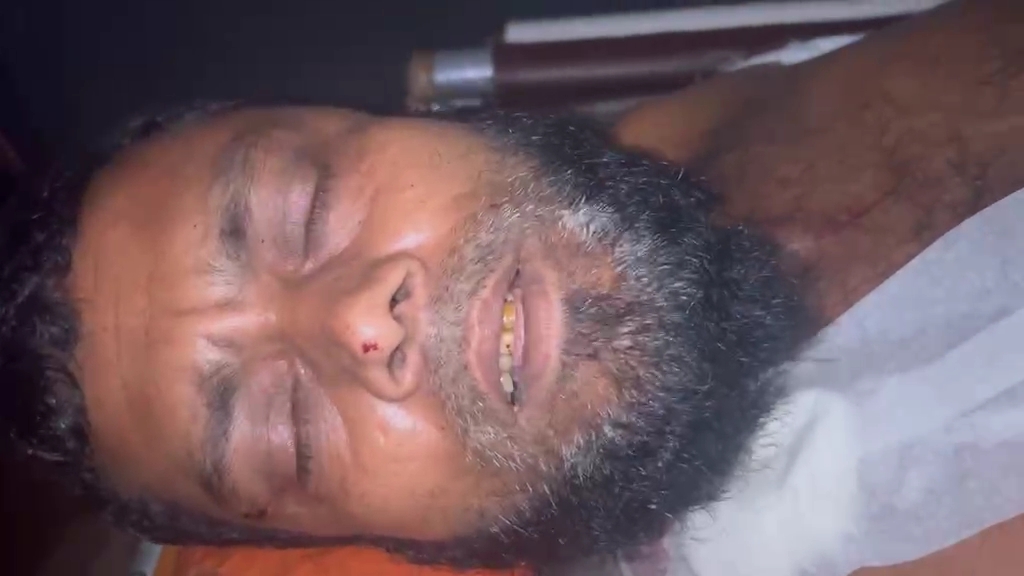 পাঁচবিবিতে পূর্ব শত্রুতার জেরে নৃশংস হামলা, কৃষক মৃত্যুর সাথে পাঞ্জা লড়ছেন