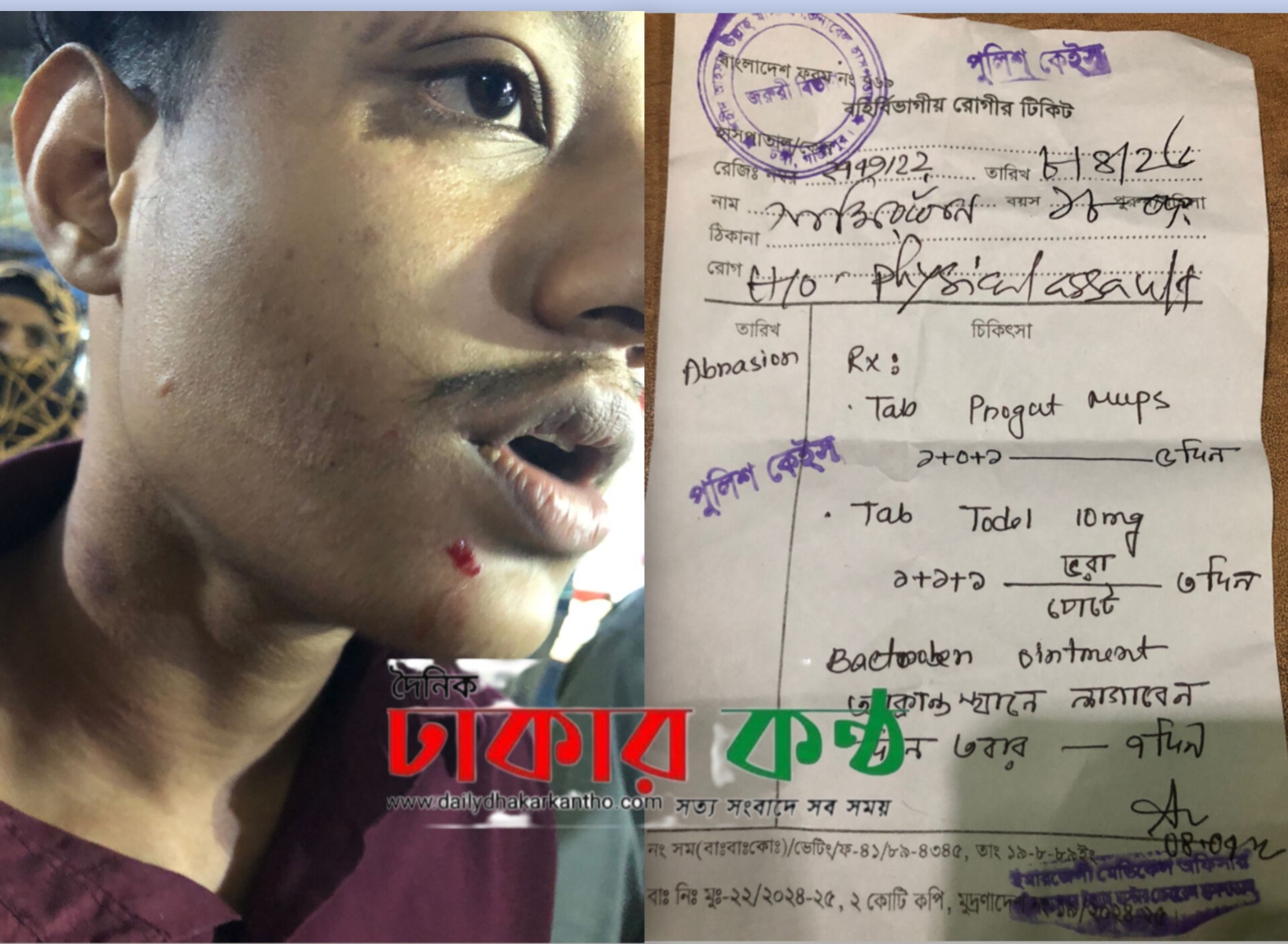 টঙ্গীতে মোটরসাইকেল রাখা নিয়ে রক্তাক্ত সংঘর্ষ: কলেজ ছাত্র গুরুতর আহত