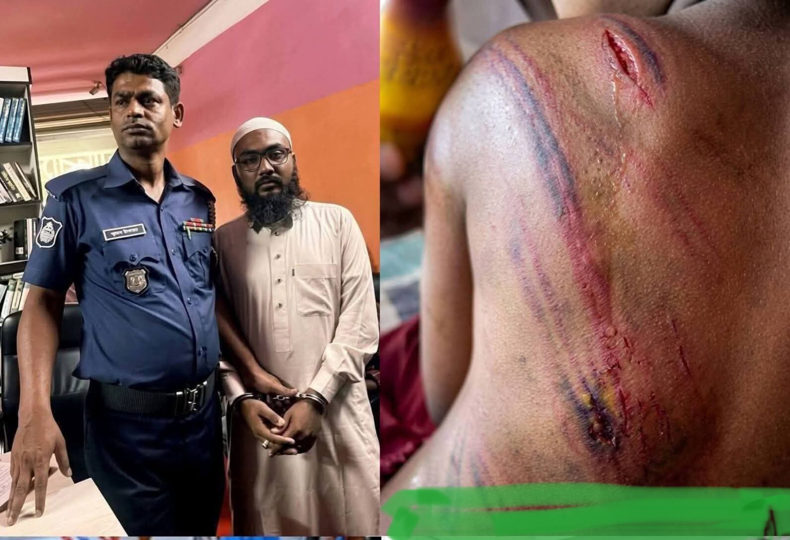 শিক্ষার আড়ালে নির্যাতন: শিশুর শরীরে নির্মমতার দাগ, ক্ষোভে ফুঁসছে সমাজ