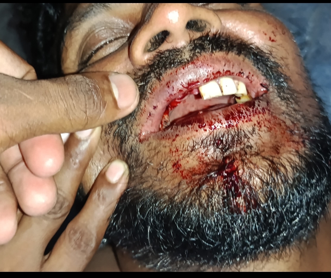 নেত্রকোনায় সিএনজি চালককে মারধরের অভিযোগ, ৫ জনের বিরুদ্ধে থানায় অভিযোগ